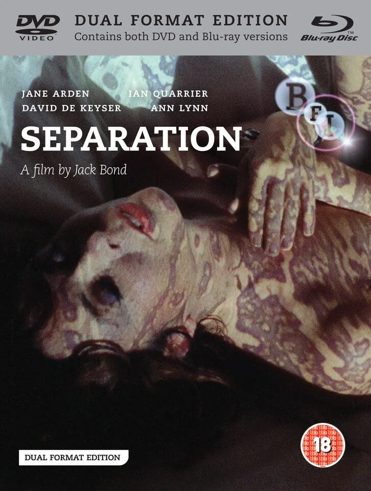Separation (Blu-Ray en DVD) Afbeelding 1