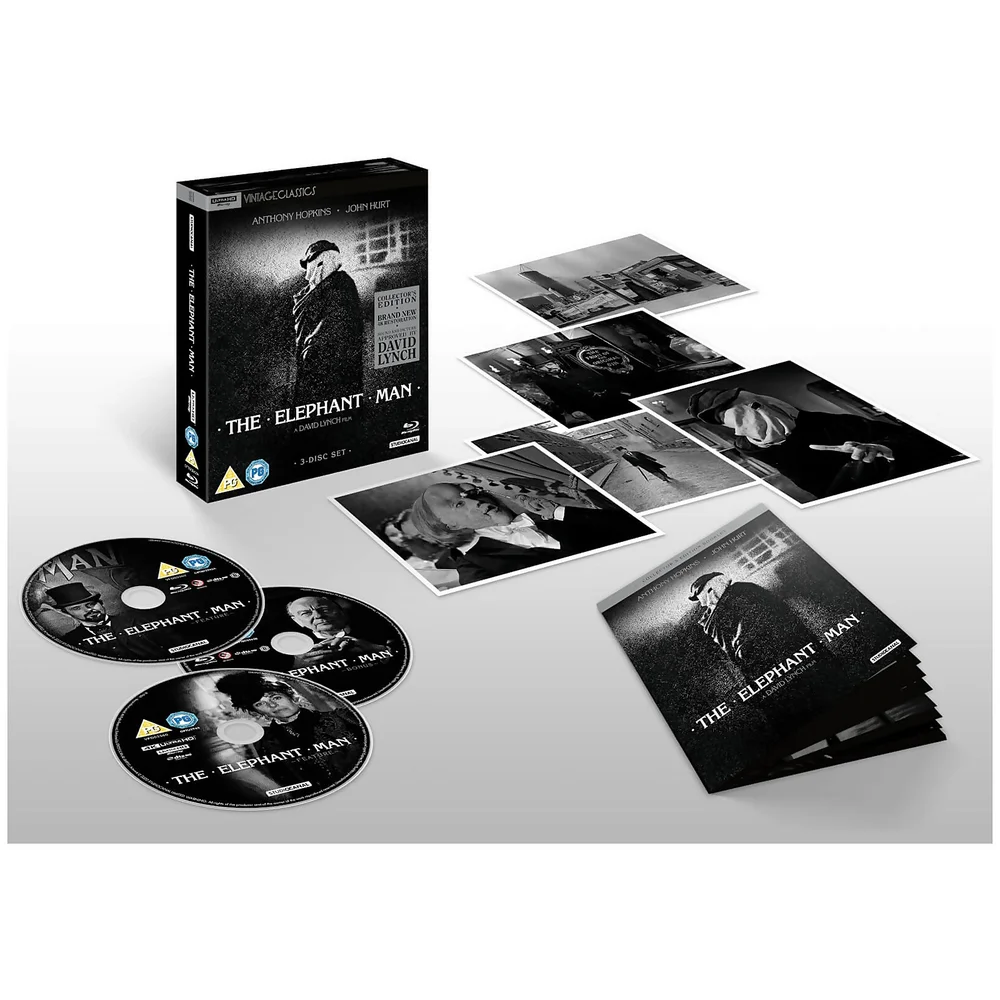 The Elephant Man (40e Jubileum Edition) - Collector's Edition Afbeelding 1